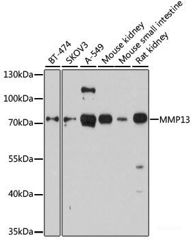 Western blot analysis of extracts of various cell lines using STIP1 Polyclonal Antibody at dilution of 1:1000.
