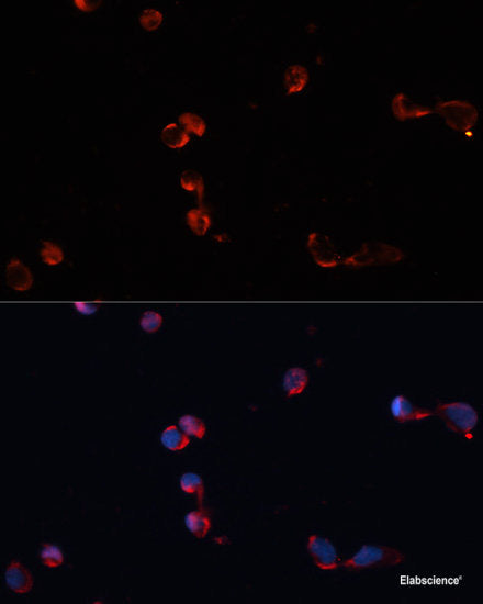 Western blot analysis of extracts of Mouse brain using HRAS Polyclonal Antibody at dilution of 1:3000.