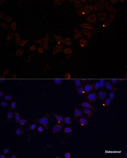 Western blot analysis of extracts of various cell lines using CST8 Polyclonal Antibody at dilution of 1:1000.