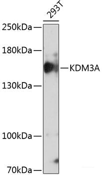 Immunohistochemistry of paraffin-embedded Mouse brain using CHRM1 Polyclonal Antibody at dilution of 1:100 (40x lens).