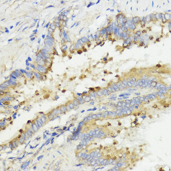 Immunohistochemistry of paraffin-embedded Human tonsil using SPTA1 Polyclonal Antibody at dilution of 1:100 (40x lens).
