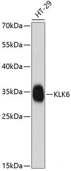 Immunohistochemistry of paraffin-embedded Human prostate using ApoE Polyclonal Antibody at dilution of 1:100 (40x lens).