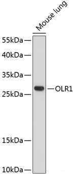 Immunofluorescence analysis of C6 cells using ATP1B1 Polyclonal Antibody at dilution of 1:100. Blue: DAPI for nuclear staining.