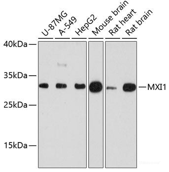 Immunohistochemistry of paraffin-embedded Rat pancreas using FLT3 Polyclonal Antibody at dilution of 1:100 (40x lens).