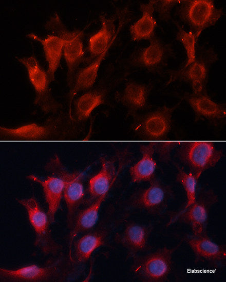 Immunohistochemistry of paraffin-embedded Mouse lung using TOPBP1 Polyclonal Antibody at dilution of 1:100 (40x lens).