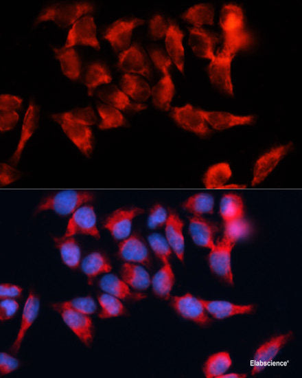 Immunohistochemistry of paraffin-embedded Mouse kidney using JADE1 Polyclonal Antibody at dilution of 1:100 (40x lens).