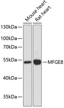 Immunofluorescence analysis of MCF7 cells using STRN3 Polyclonal Antibody