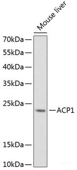 Western blot analysis of extracts of various cell lines using HEL308 Polyclonal Antibody at dilution of 1:3000.