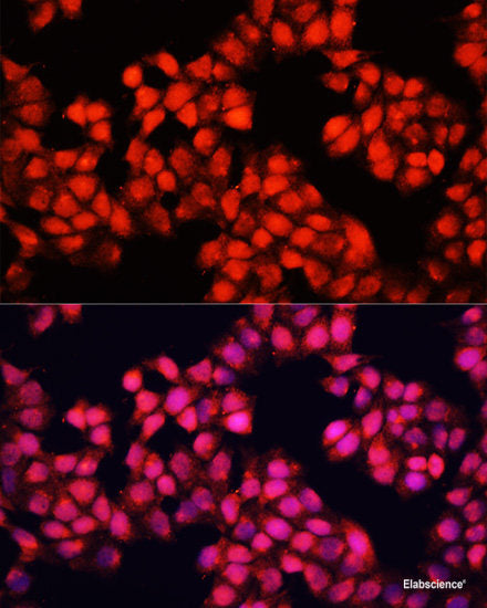 Western blot analysis of extracts of various cell lines using AREG Polyclonal Antibody at dilution of 1:3000.