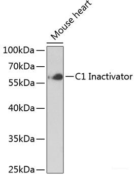 Western blot analysis of extracts of Rat kidney using HMGA1 Polyclonal Antibody at dilution of 1:3000.