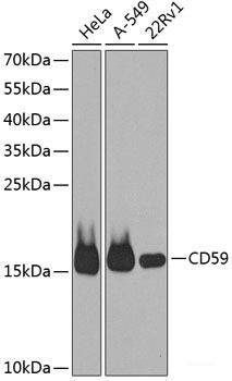 Western blot analysis of extracts of various cell lines using CUL4B Polyclonal Antibody at dilution of 1:1000.
