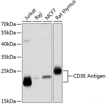 Immunofluorescence analysis of C6 cells using PSME3 Polyclonal Antibody at dilution of 1:100 (40x lens). Blue: DAPI for nuclear staining.