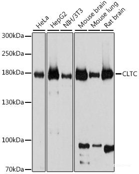 Immunofluorescence analysis of NIH/3T3 cells using CD133 Polyclonal Antibody at dilution of 1:100. Blue: DAPI for nuclear staining.