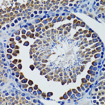 Immunofluorescence analysis of NIH/3T3 cells using SLC25A19 Polyclonal Antibody at dilution of 1:100. Blue: DAPI for nuclear staining.