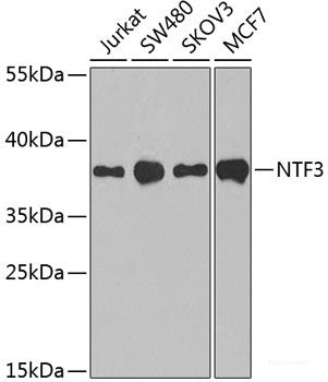 Immunohistochemistry of paraffin-embedded Rat brain using TH Polyclonal Antibody at dilution of 1:200 (40x lens).