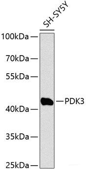 Immunohistochemistry of paraffin-embedded Rat lung using NAT2 Polyclonal Antibody at dilution of 1:100 (40x lens).