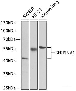 Western blot analysis of extracts of various cell lines using CAV3 Polyclonal Antibody at dilution of 1:3000.
