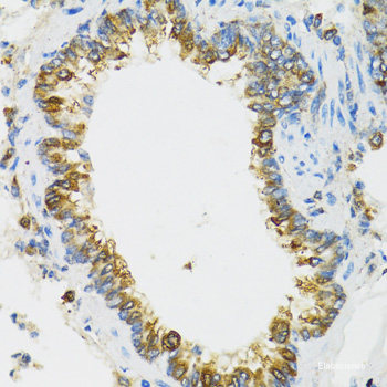 Immunohistochemistry of paraffin-embedded Rat spleen using VEGF Receptor 1 Polyclonal Antibody at dilution of 1:100 (40x lens).