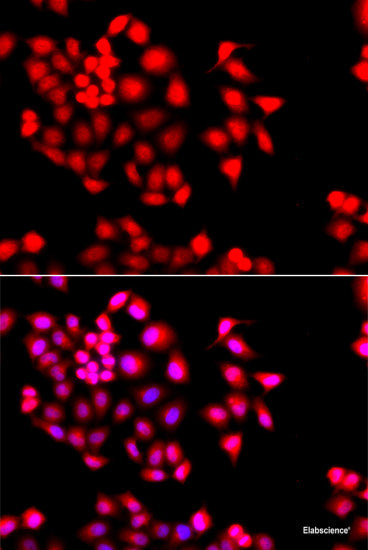 Western blot analysis of extracts of various cell lines using ANGEL2 Polyclonal Antibody at dilution of 1:3000.
