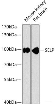 Immunohistochemistry of paraffin-embedded Human liver using GPC4 Polyclonal Antibody at dilution of 1:100 (40x lens).