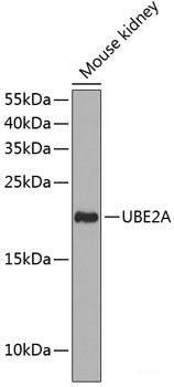 Immunofluorescence analysis of Mouse brain using SNX13 Polyclonal Antibody at dilution of 1:100. Blue: DAPI for nuclear staining.