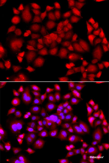 Immunofluorescence analysis of C6 cells using P Glycoprotein Polyclonal Antibody at dilution of 1:100. Blue: DAPI for nuclear staining.