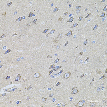 Western blot analysis of extracts of various cell lines using SPOCK3 Polyclonal Antibody at dilution of 1:3000.