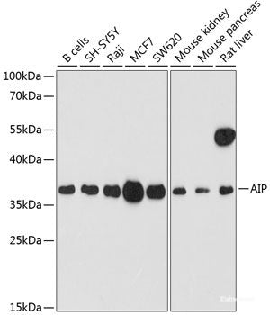 Western blot analysis of extracts of various cell lines using ZBTB33 Polyclonal Antibody at dilution of 1:3000.