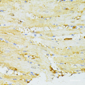 Immunohistochemistry of paraffin-embedded Human prostate using LIF Polyclonal Antibody at dilution of 1:100 (40x lens).