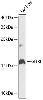 Western blot analysis of extracts of various cell lines using CLN5 Polyclonal Antibody at dilution of 1:3000.