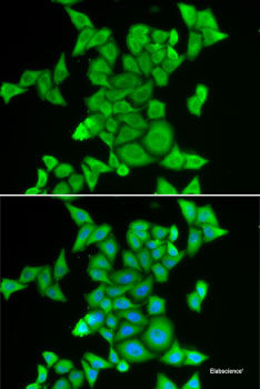Immunofluorescence analysis of L929 cells using PALD1 Polyclonal Antibody at dilution of 1:100 (40x lens). Blue: DAPI for nuclear staining.