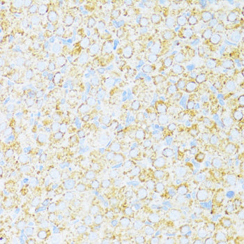 Western blot analysis of extracts of Rat pancreas using PNLIPRP2 Polyclonal Antibody at dilution of 1:3000.