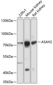 Western blot analysis of extracts of various cell lines using SCGN Polyclonal Antibody at dilution of 1:3000.