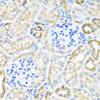 Immunohistochemistry of paraffin-embedded Rat brain using IFNL3 Polyclonal Antibody at dilution of 1:100 (40x lens).