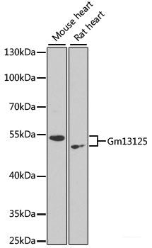 Western blot analysis of extracts of various cell lines using AVEN Polyclonal Antibody at dilution of 1:3000.