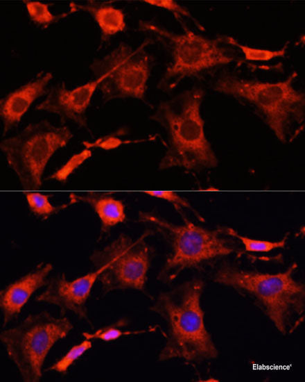 Immunohistochemistry of paraffin-embedded Rat testis using DNAJB11 Polyclonal Antibody at dilution of 1:100 (40x lens).