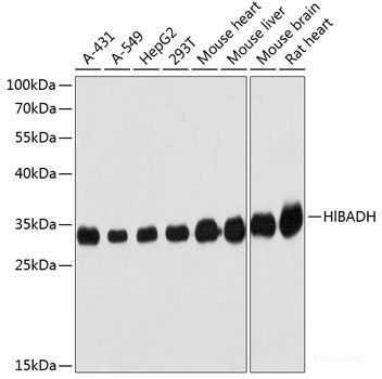 Western blot analysis of extracts of various cell lines using RAP1B Polyclonal Antibody at dilution of 1:3000.