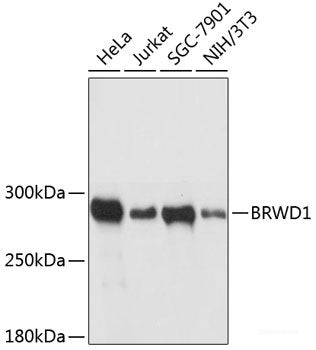 Immunohistochemistry of paraffin-embedded Human stomach using VAPA Polyclonal Antibody at dilution of 1:100 (40x lens).