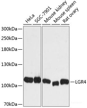 Western blot analysis of extracts of various cell lines using COMT Polyclonal Antibody at dilution of 1:1000.