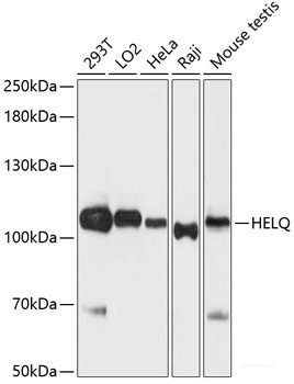 Immunohistochemistry of paraffin-embedded Human liver using CDK7 Polyclonal Antibody at dilution of 1:150 (40x lens).
