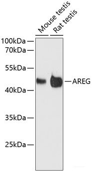 Immunohistochemistry of paraffin-embedded Human tonsil using ECH1 Polyclonal Antibody at dilution of 1:150 (40x lens).
