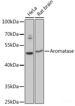 Immunofluorescence analysis of U-2 OS cells using HSD17B8 Polyclonal Antibody at dilution of 1:100 (40x lens). Blue: DAPI for nuclear staining.
