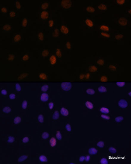 Immunohistochemistry of paraffin-embedded Human tonsil using ZMYM3 Polyclonal Antibody at dilution of 1:100 (40x lens).