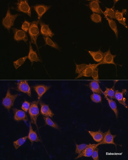 Immunofluorescence analysis of L929 cells using TNFRSF11A Polyclonal Antibody at dilution of 1:100 (40x lens). Blue: DAPI for nuclear staining.