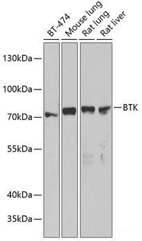 Western blot analysis of extracts of various cell lines using TBCB Polyclonal Antibody at dilution of 1:3000.