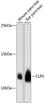 Western blot analysis of extracts of various cell lines using NDUFS8 Polyclonal Antibody at dilution of 1:3000.
