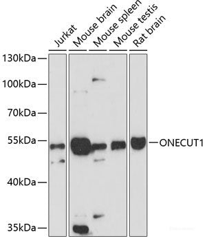 Western blot analysis of extracts of various cell lines using OVGP1 Polyclonal Antibody at dilution of 1:3000.