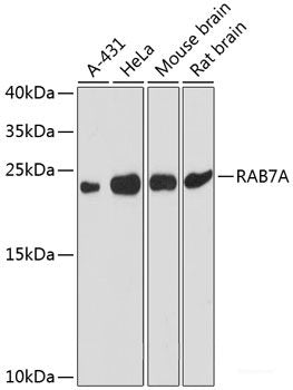 Immunohistochemistry of paraffin-embedded Mouse retina using SAG Polyclonal Antibody at dilution of 1:200 (40x lens).
