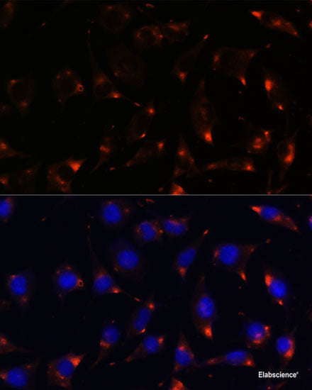 Western blot analysis of extracts of various cell lines using SREBF2 Polyclonal Antibody at dilution of 1:1000.