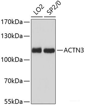 Western blot analysis of extracts of Mouse liver using XDH Polyclonal Antibody at dilution of 1:3000.